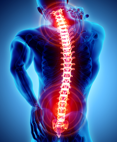 Spine Subluxation treatment in Coconut Creek Florida